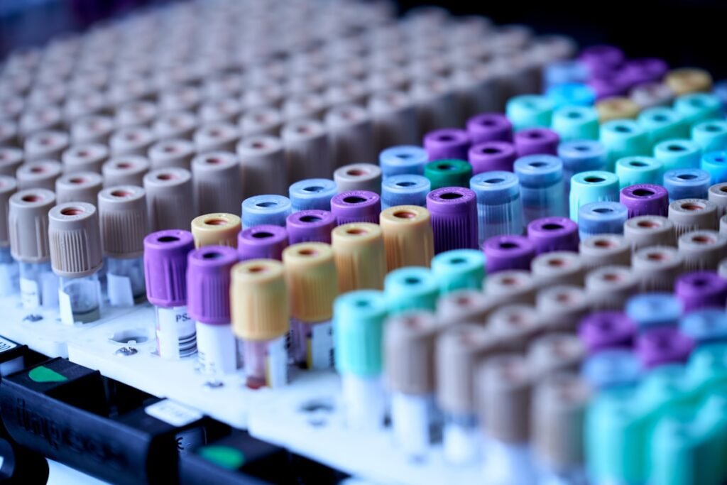 signs of low testosterone - blood test tube rack in a lab for testosterone testing