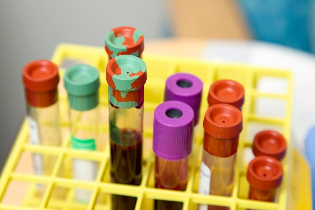 free vs total testosterone - blood sample vials in a lab rack