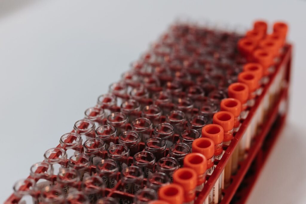 Rack of blood sample tubes with red caps