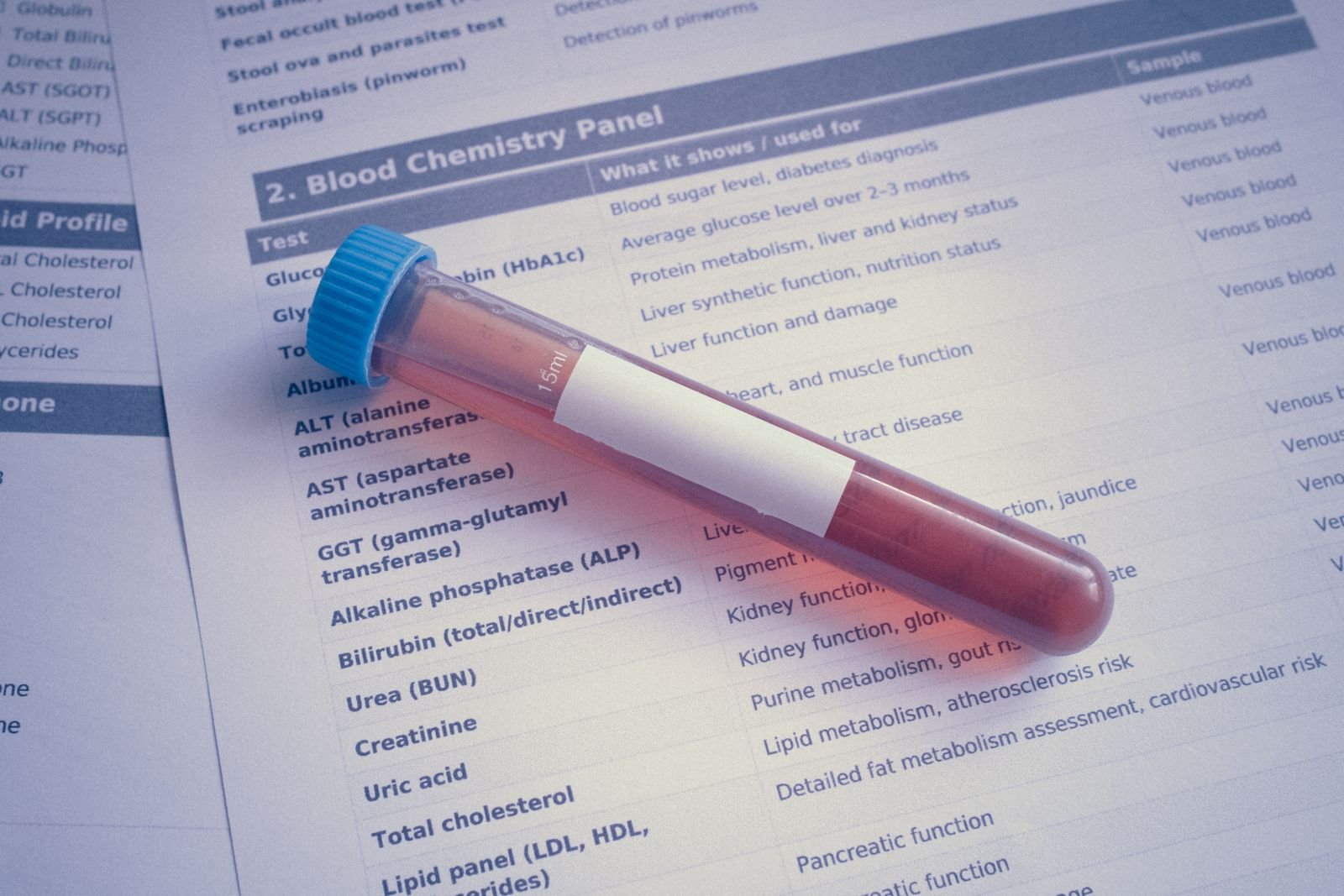 Blood sample tube on a lab report, the kind of test used to check testosterone in men