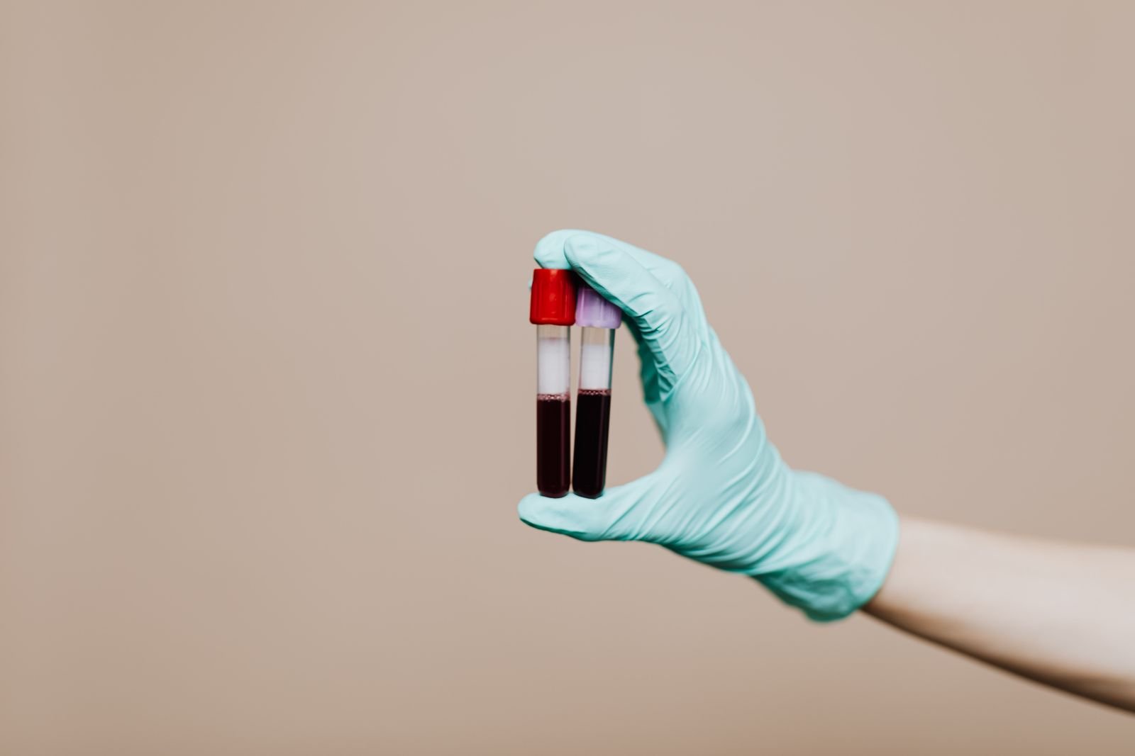 Blood tubes for a thyroid test in men