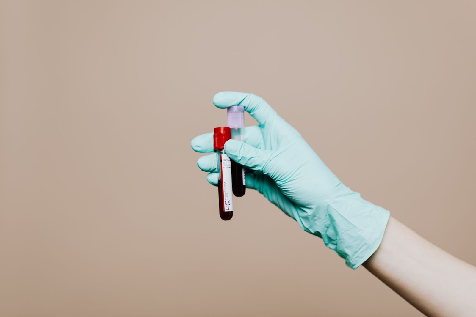 Gloved hand holding a blood sample tube