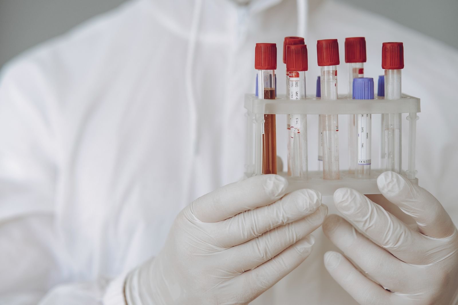 Gloved hands holding blood sample tubes