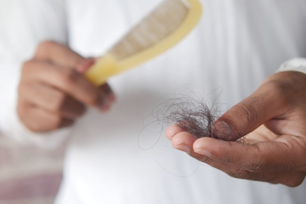 Man holding a comb and strands of shed hair