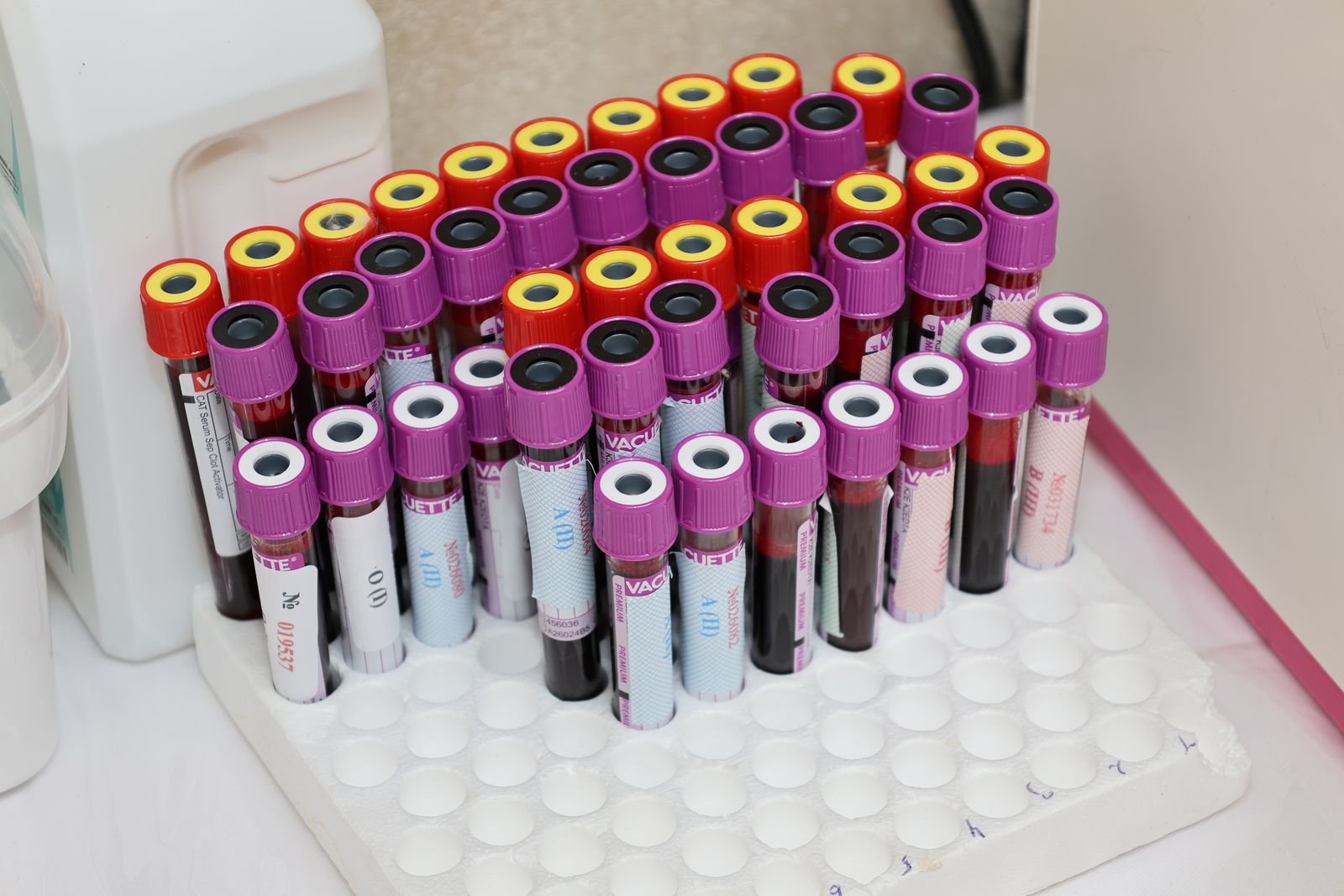 Rack of blood sample tubes in a laboratory